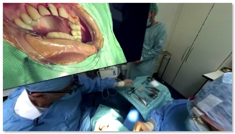 image immediate implant virtual reality